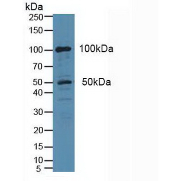 Cytosolic Phospholipase A2 (PLA2G4) Human Polyclonal Antibody