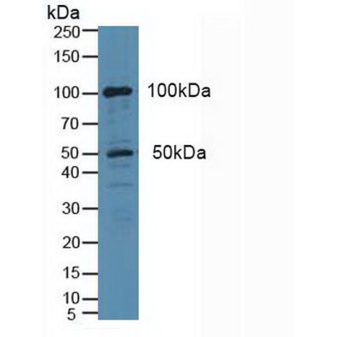 Cytosolic Phospholipase A2 (PLA2G4) Human Polyclonal Antibody