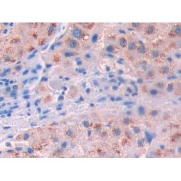 Interleukin 10 Receptor Alpha (IL10Ra) Human Polyclonal Antibody