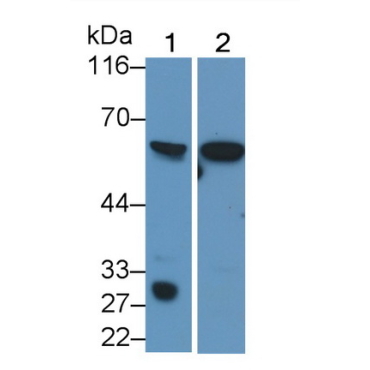 Interleukin 10 Receptor Alpha (IL10Ra) Mouse Polyclonal Antibody