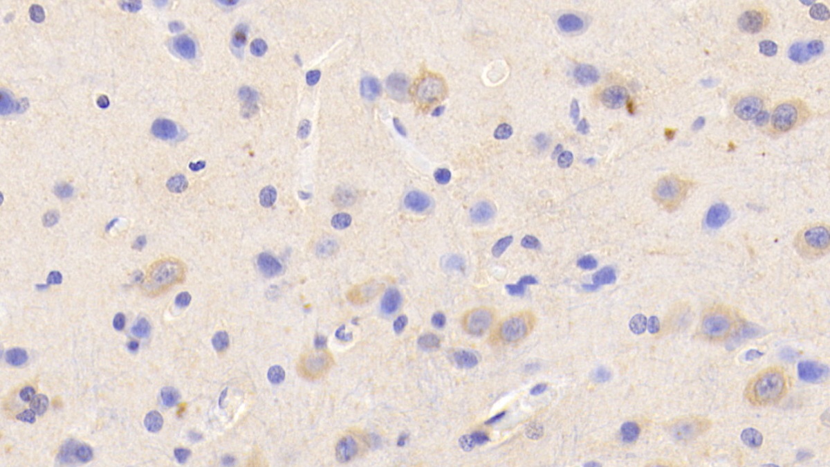 Potassium Chloride Cotransporters 4 (KCC4) Human Polyclonal Antibody