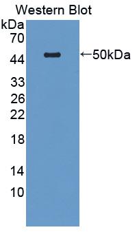 Potassium Chloride Cotransporters 3 (KCC3) Human Polyclonal Antibody