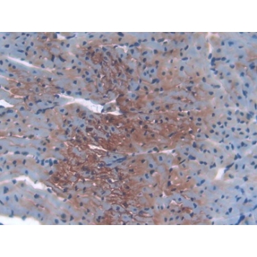 Insulin Like Growth Factor 2 Receptor (IGF2R) Mouse Polyclonal Antibody
