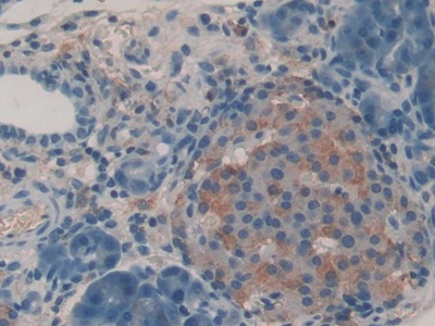 Insulin Like Growth Factor 2 Receptor (IGF2R) Rat Polyclonal Antibody
