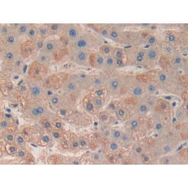 MAP Kinase Activated Protein Kinase 3 (MAPKAPK3) Human Polyclonal Antibody