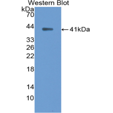 Ankyrin 1, Erythrocytic (ANK1) Human Polyclonal Antibody