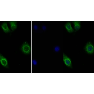 Interleukin 10 Receptor Beta (IL10Rb) Human Polyclonal Antibody