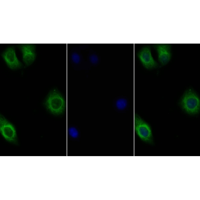 Interleukin 10 Receptor Beta (IL10Rb) Human Polyclonal Antibody