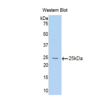 Interleukin 10 Receptor Beta (IL10Rb) Mouse Polyclonal Antibody