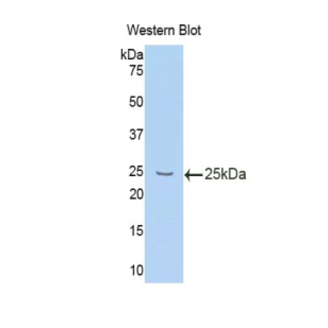 Interleukin 10 Receptor Beta (IL10Rb) Mouse Polyclonal Antibody
