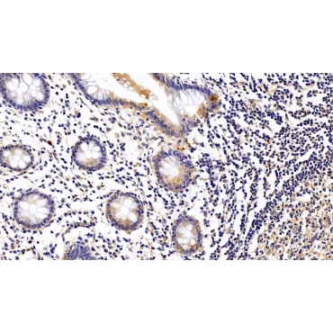 Interleukin 12 Receptor Beta 1 (IL12Rb1) Human Polyclonal Antibody