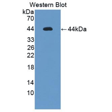 Interleukin 12 Receptor Beta 1 (IL12Rb1) Mouse Polyclonal Antibody