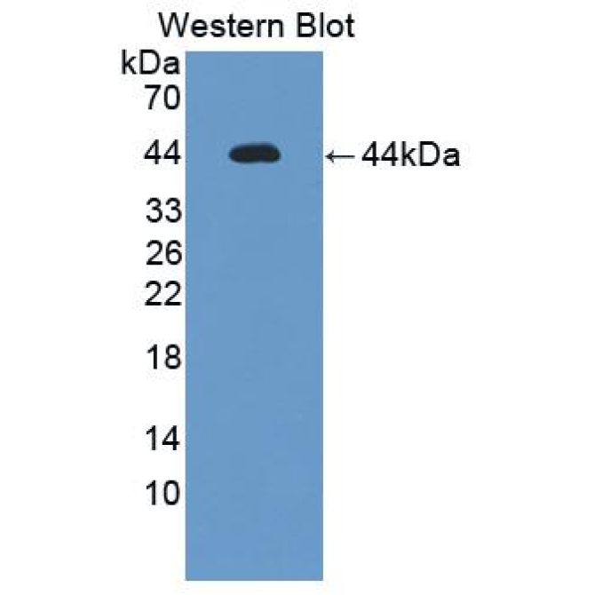Interleukin 12 Receptor Beta 1 (IL12Rb1) Mouse Polyclonal Antibody