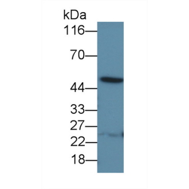 Interleukin 13 Receptor Alpha 1 (IL13Ra1) Human Polyclonal Antibody