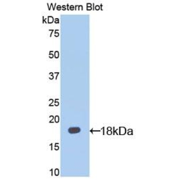 Interleukin 13 Receptor Alpha 1 (IL13Ra1) Mouse Polyclonal Antibody