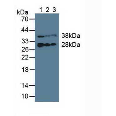 Electron Transfer Flavoprotein Beta Polypeptide (ETFb) Human Polyclonal Antibody