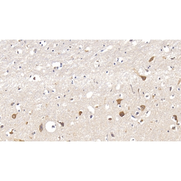 Interleukin 17 Receptor A (IL17RA) Human Polyclonal Antibody