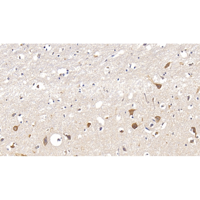 Interleukin 17 Receptor A (IL17RA) Human Polyclonal Antibody