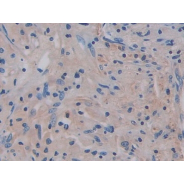 Interleukin 17 Receptor A (IL17RA) Human Polyclonal Antibody