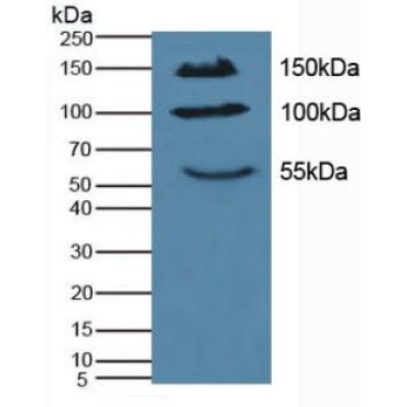 Interleukin 17 Receptor A (IL17RA) Mouse Polyclonal Antibody