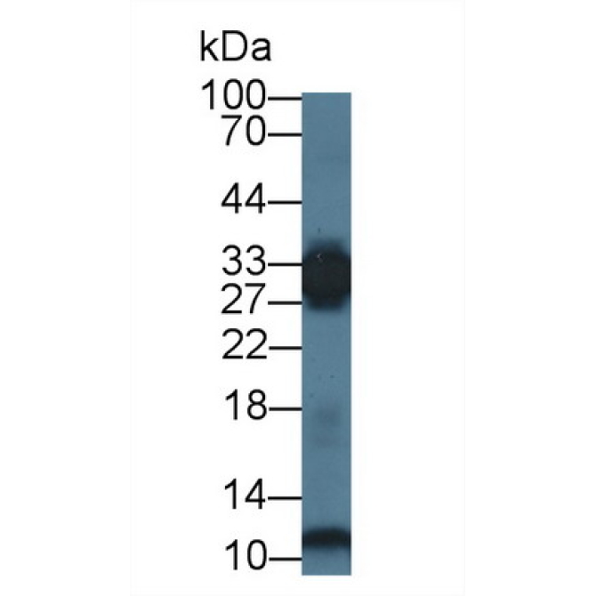 Phosphoglycerate Mutase 2, Muscle (PGAM2) Human Polyclonal Antibody