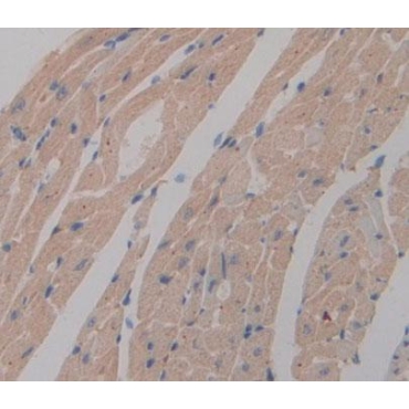 Phosphoglycerate Mutase 2, Muscle (PGAM2) Mouse Polyclonal Antibody