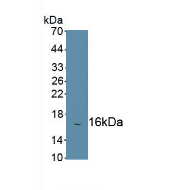 Chemokine C-C-Motif Receptor 7 (CCR7) Mouse Polyclonal Antibody