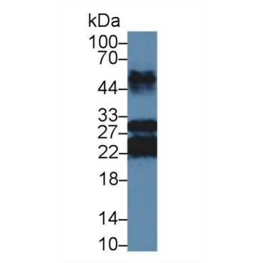Major Basic Protein (MBP) Bovine (Cattle) Polyclonal Antibody