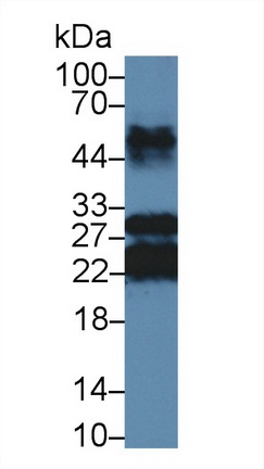 Major Basic Protein (MBP) Bovine (Cattle) Polyclonal Antibody