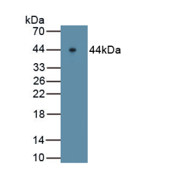 Major Basic Protein (MBP) Human Polyclonal Antibody