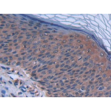 Chemokine (C-X-C Motif) Ligand 27 (CCL27) Human Polyclonal Antibody