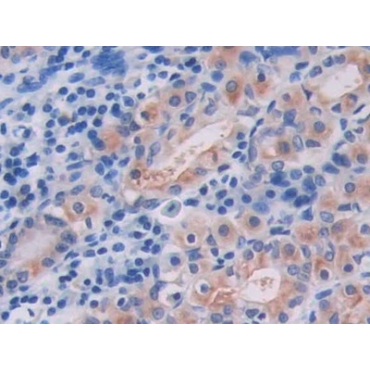 Interleukin 18 Receptor 1 (IL18R1) Human Polyclonal Antibody