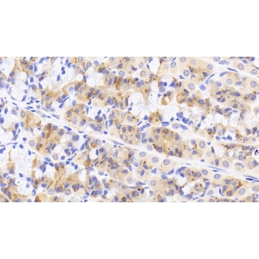 Interleukin 18 Receptor 1 (IL18R1) Human Polyclonal Antibody