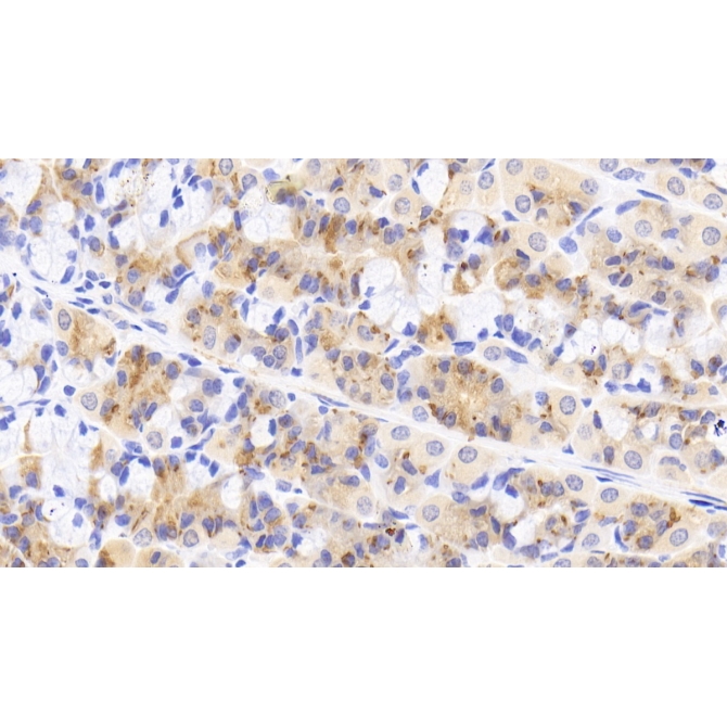 Interleukin 18 Receptor 1 (IL18R1) Human Polyclonal Antibody