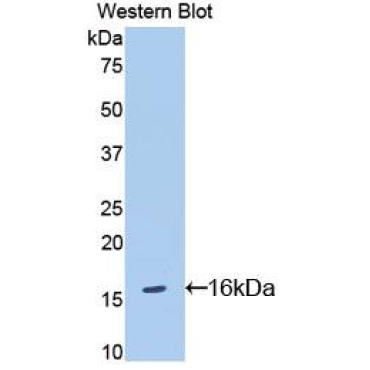 Interleukin 18 Receptor 1 (IL18R1) Mouse Polyclonal Antibody