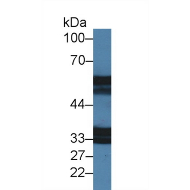 Interleukin 18 Receptor 1 (IL18R1) Mouse Polyclonal Antibody