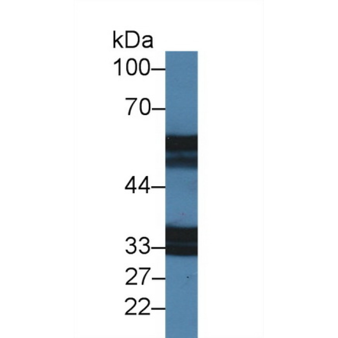 Interleukin 18 Receptor 1 (IL18R1) Mouse Polyclonal Antibody