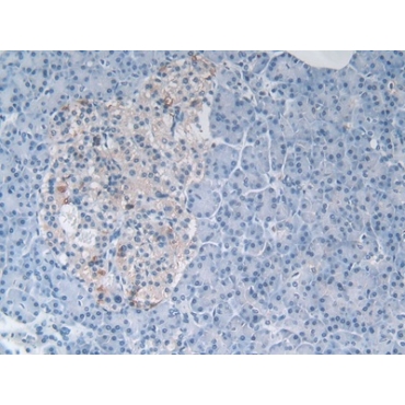 Myostatin (MSTN) Human Polyclonal Antibody