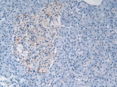 Myostatin (MSTN) Human Polyclonal Antibody