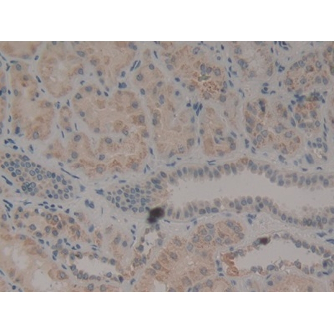 Myostatin (MSTN) Human Polyclonal Antibody