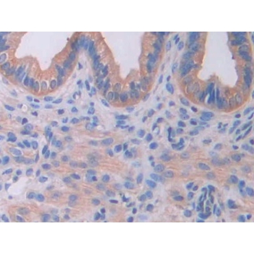 Interleukin-18 Receptor Beta (IL18R Beta) Mouse Polyclonal Antibody