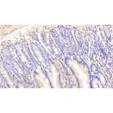 Interleukin-18 Receptor Beta (IL18R Beta) Mouse Polyclonal Antibody