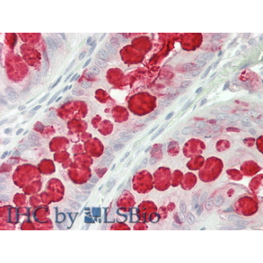 Trefoil Factor 3 (TFF3) Human Polyclonal Antibody
