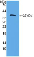 Trefoil Factor 3 (TFF3) Mouse Polyclonal Antibody