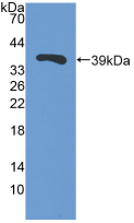 Trefoil Factor 3 (TFF3) Pig Polyclonal Antibody