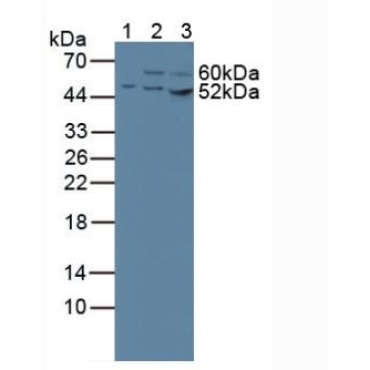 Citrate Synthase (CS) Human Polyclonal Antibody