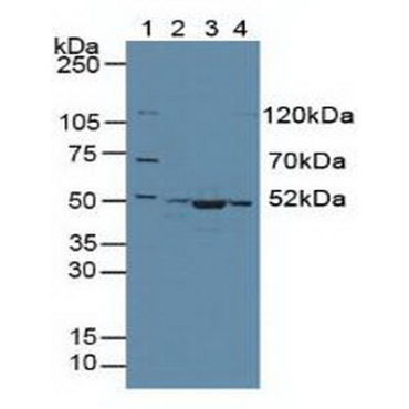 Citrate Synthase (CS) Mouse Polyclonal Antibody