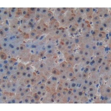 Malonyl Coenzyme A Decarboxylase (MLYCD) Human Polyclonal Antibody