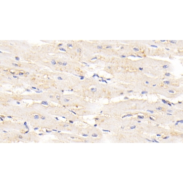 Titin (TTN) Human Polyclonal Antibody