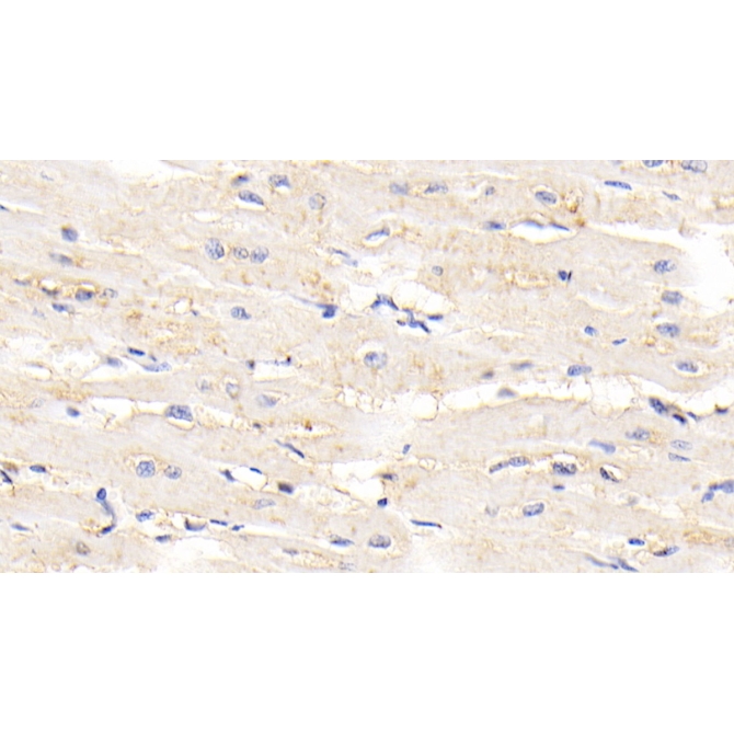 Titin (TTN) Human Polyclonal Antibody